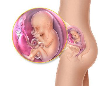 Passivamente adquirida Natural: Congênita conferida por anticorpos transferidos da mãe para o feto, através da placenta.colostro. Leite materno.