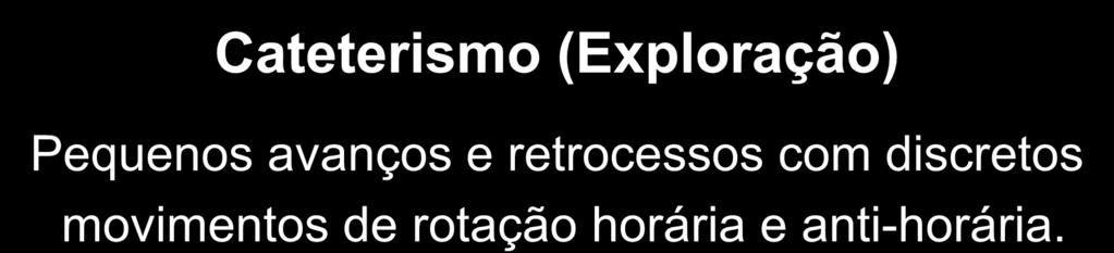 MOVIMENTOS DOS INSTRUMENTOS ENDODÔNTICOS Cateterismo (Exploração) Pequenos