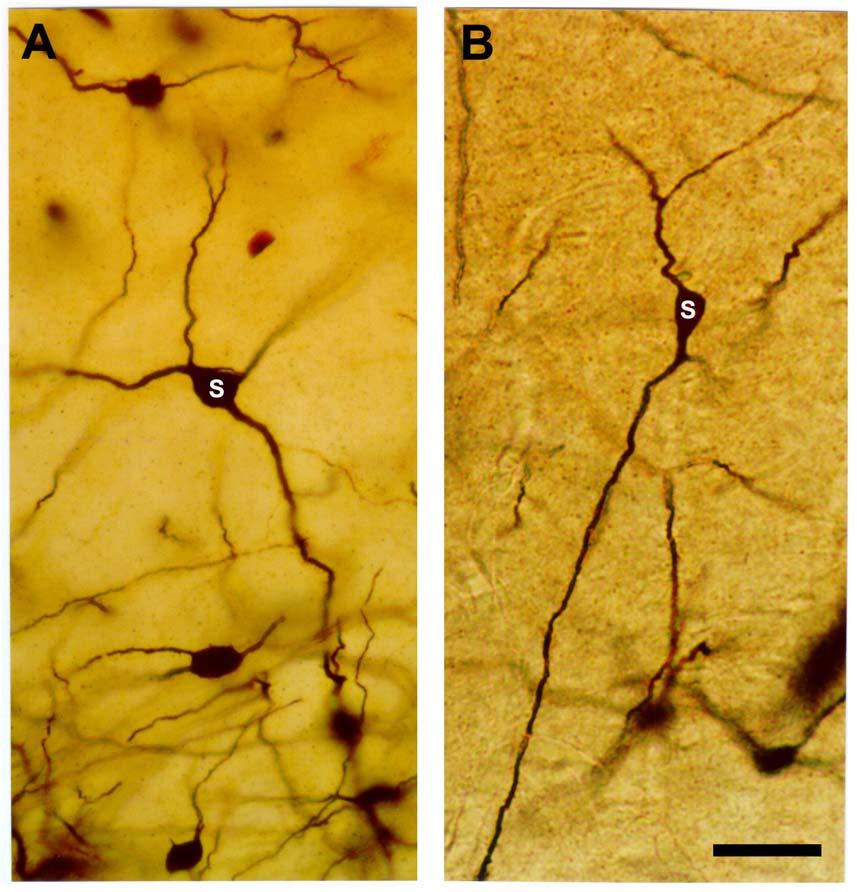 15 Figura 3. Fotomicrografias de neurônios, impregnados pela técnica de Golgi modificada, de tipo estrelado (A) ou bipenachado (B) do subnúcleo pósterodorsal da amígdala medial de rata adulta.