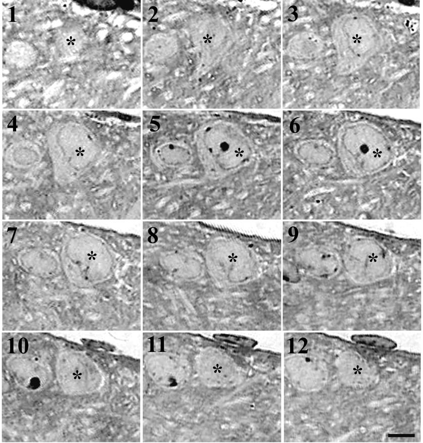 Figure 6. Fotomicrografia de cortes semifinos seriados mostrando secções em diferentes níveis (112) do soma neuronal (*) da amígdala medial pósteroventral de ratas em diestro.