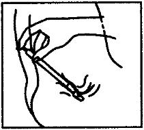 Fure o lacre da bisnaga com o fundo da tampa; 3. Retire o aplicador do invólucro e atarraxe-o firmemente no bico da bisnaga aberta; 4.