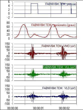 41 A - sensor B - eletrogoniometro C - VMO D - VLL E VLO FIGURA 6: Exemplo de um sinal elétrico selecionado através do software AqDAnalysis 7.02.