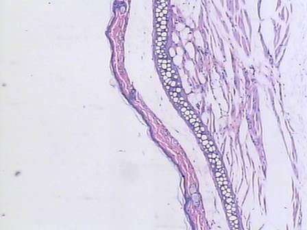 Acentuada atrofia da epiderme com apenas 2 camadas de células no estrato epitelial e diminuição no número de folículos pilosos e