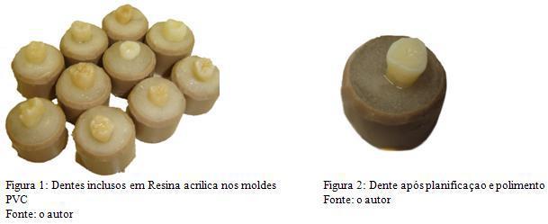 23 b) População e amostra: Foram utilizados neste experimento 40 terceiros molares humanos hígidos extraídos por motivos diversos e mantidos armazenados no Banco de Dentes Humanos da UNOESC/Joaçaba