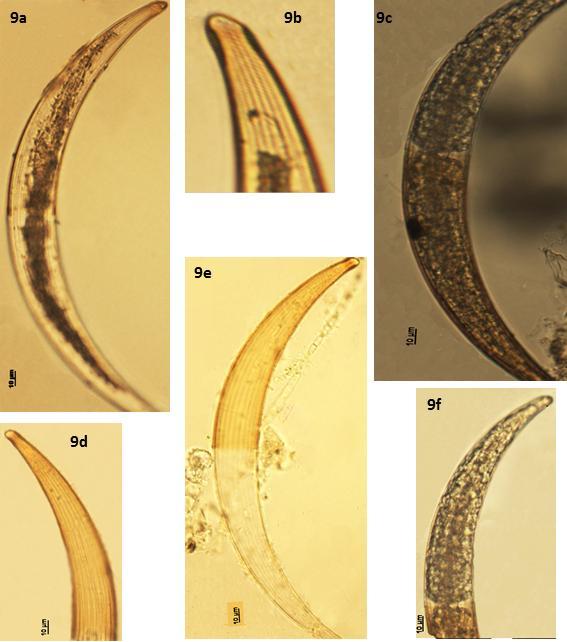 Figuras 9a-f Closterium costatum var.