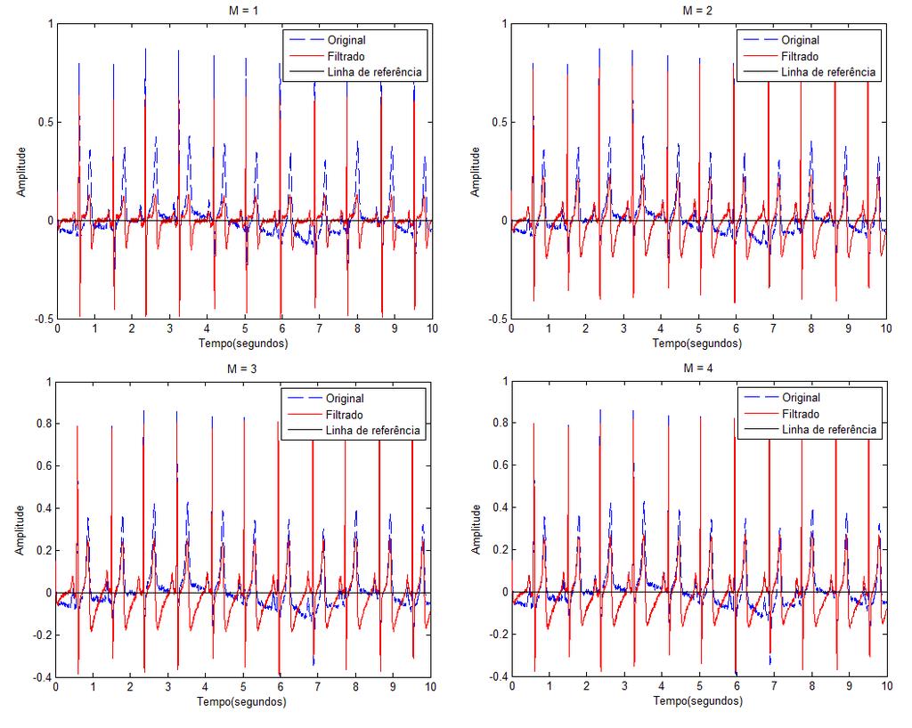 A Figura 4.2.5 evidencia que o filtro IIR Chebyshev tipo 2 distorceu mais o sinal em comparação aos filtros IIR estudados. Isso se deve às oscilações na banda de rejeição que esse filtro proporciona.