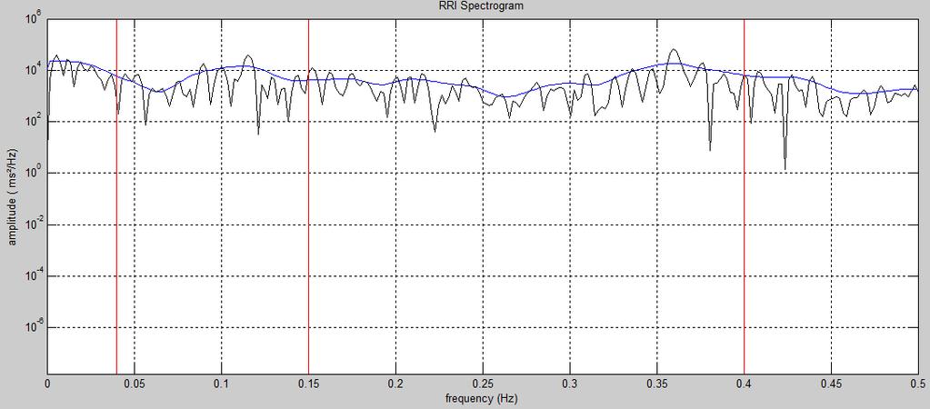 3000 2500 2000 1500 Y Axis 1000 500 0 Figura 4.4.1 Gráfico estatístico de baixa frequência (LF) por Welch (W) que mostra que os métodos não são estatisticamente diferentes.