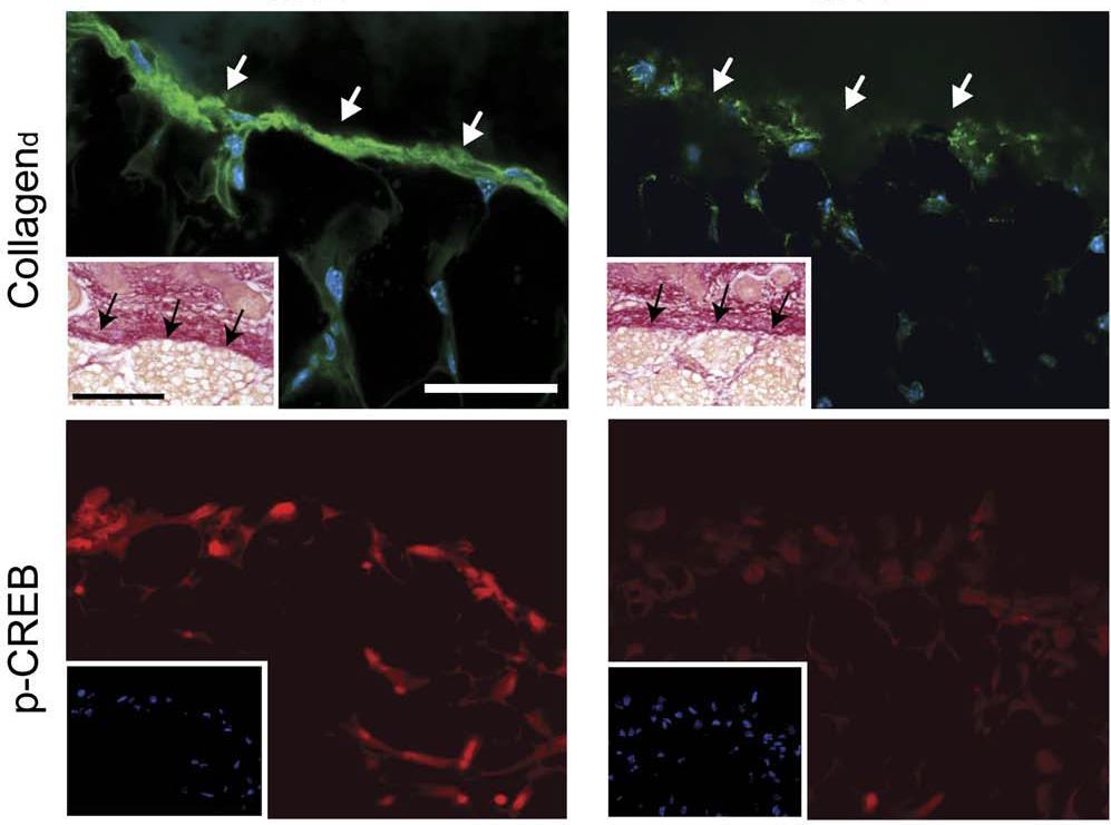 colágeno degradado P-CREB (camp response element binding protein) O anticorpo usado reconhece Colágeno degradado, portanto a marcação é + forte no animal selvagem, (pois