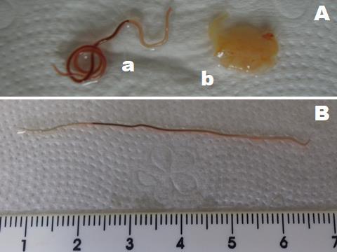 12 manualmente, e aplicar técnicas para matar os nematoides na carne do peixe, embora deva-se optar pela eliminação como forma mais eficaz. Fig. 04. Contracaecum spp.