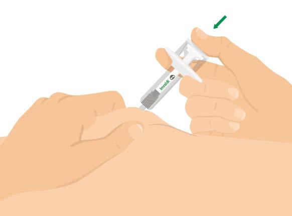 Apertar a pele e introduzir a agulha Aperte suavemente a pele e introduza toda a agulha num ângulo de aproximadamente 45 graus. 7.