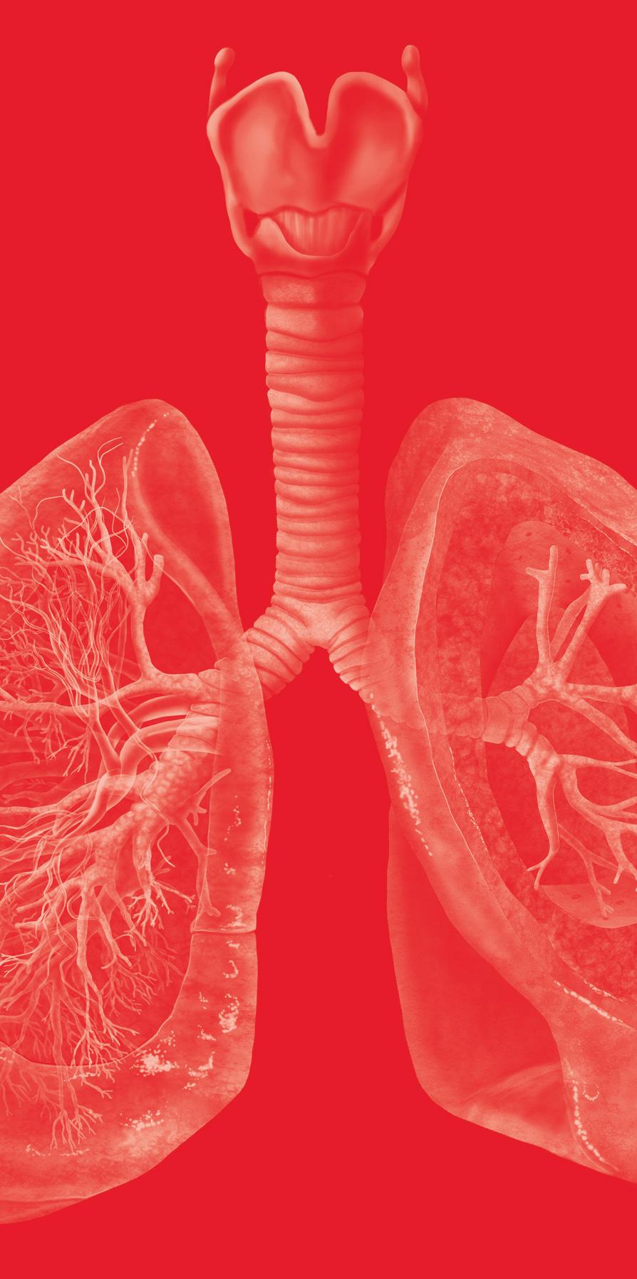 Rodrigo Antônio Brandão Neto Fabrício Martins Valois As doenças pulmonares parenquimatosas difusas ou Doenças Pulmonares Intersticiais (DPIs) envolvem o parênquima pulmonar, ou seja, o alvéolo, a