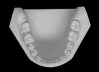 A B Figura 8 - Radiografia