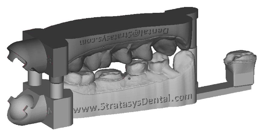 Considerações do laboratório Um arquivo de formato aberto STL da Itero foi importado para o software CAD, Dental Manager (3Shape).