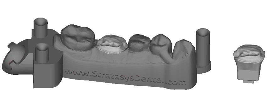 Figura 5: Arcada sólida e matriz. Figura 6: Arcada sólida e ponte.