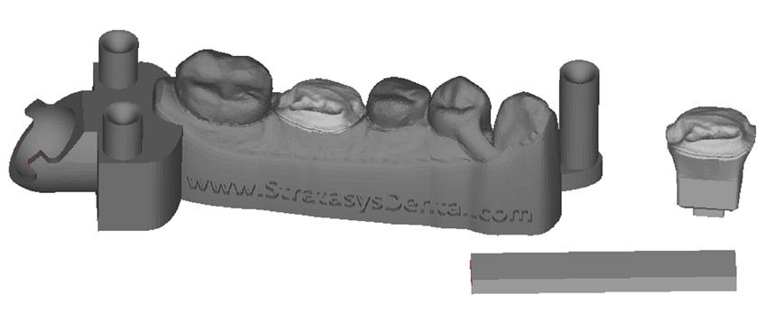 assim a validação do aparelho já no laboratório. A coroa foi, então, colorida, vitrificada e seguiu para o dentista realizar a intercuspidação.