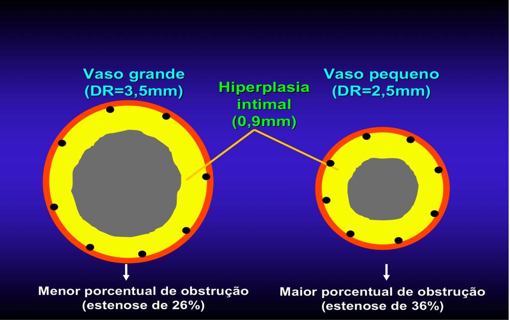 4 especificamente, Hoffmann et al, em 1998, em estudo seriado com USIC, observaram que a resposta de HNI tinha magnitude constante, independente do diâmetro do vaso 21.