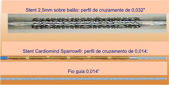 34 Figura 2 Comprovação do baixo perfil do sistema de implatação de stent Sparrow (centro) em comparação com sistema de implantação de stent expansível por balão (acima) e fio guia (abaixo).