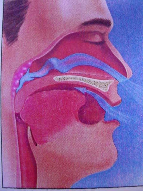 Hipopnéia Obstrutiva do Sono. (48) Figura 3B.