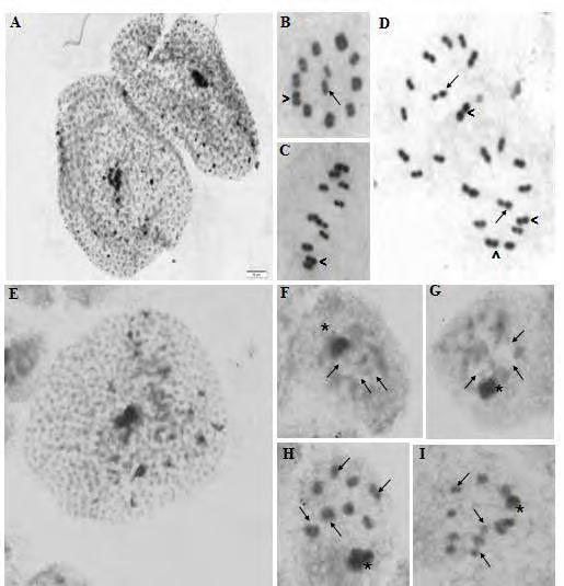 Figura 02: Triatoma platensis. A-D (Alu I). A digestão em núcleos interfásicos evidenciou um grande corpúsculo heteropicnótico e outros menores (A).