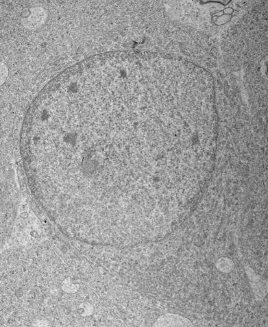 Observar possível fragmentação nucleolar (*) e a migração