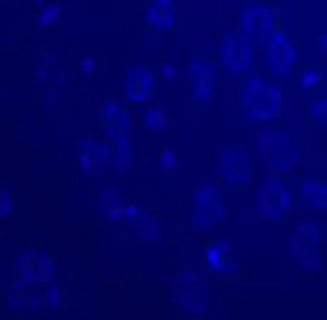 imunofluorescência em espermátides de Triatoma