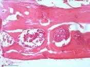 poucas áreas de fibroplasia, presença de tecido conjuntivo fibroso, na porção mais central.