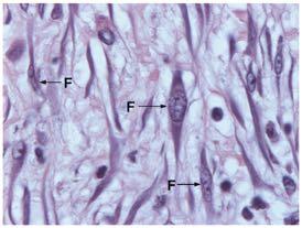 Fibroblastos,po celular mais comum do conjun,vo, pode modular sua a,vidade