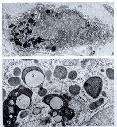 Macrófagos parte do sistema fagocitário mononuclear, derivados de