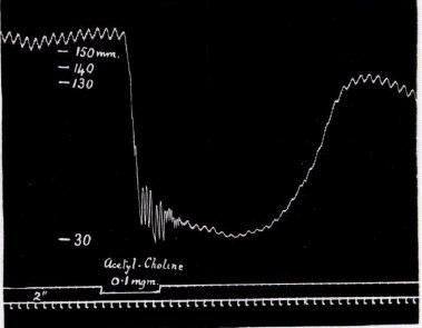 Fig. 5. Cérebro destruído. Respiração artificial.