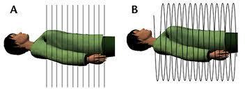 Figura 2.5 Tomografia Axial Computorizada (A); Tomografia Helicoidal Computorizada (B).