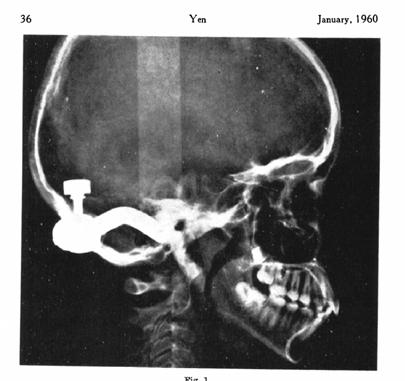 19 direito do crânio, mas não no lado esquerdo, realizando-se um estudo da anatomia radiográfica (figura 3). Figura 3 - Imagem da radiografia utilizada.