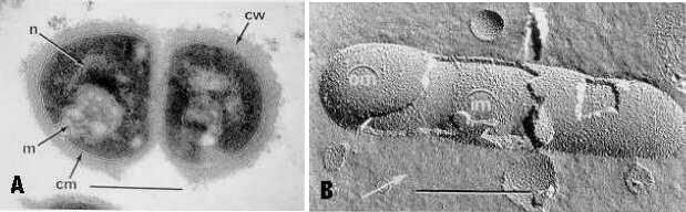 Mesossoma e Membranas Internas e Externas Micrococcus lysodeikticus