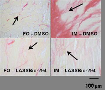 LASSBio-294: Aplicação em Modelo de Doença Infarto do Miocárdio Volume de Colágeno (%) 6 4 2 0 F