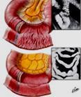 Intestino