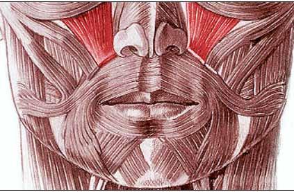 Biomodelação do sorriso gengival.