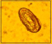 23 Nas FIGURAS 7, 8, 9 e 10 podem ser observados respectivamente fotomicrografias de ovos de Trichuris sp.