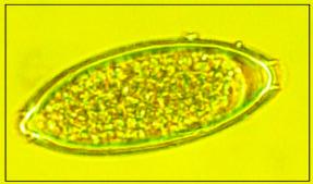 FIGURA 7: Ovo de Trichuris sp. observado nas amostras de areia analisadas pela técnica de Caldwell & Caldwell.