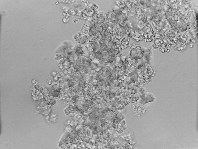 (amebas, flagelados e ciliados); A alimentação varia de acordo com seu tipo : protozoários flagelados : difusão ou transporte ativo; amebas e protozoários ciliados : fagocitose;