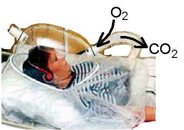 O calorímetro indireto mede as velocidades de consumo de O 2 e a produção de CO 2 permitindo calcular a despesa energética e o Quociente Respiratório (QR) QR = moles ou volume CO 2 excretado / moles
