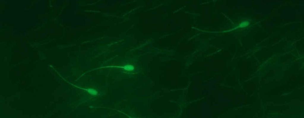 43 O diacetato de carboxifluoresceína (CFDA), o SYBR-14, o iodeto de propídio (IP) e o Hoechst 33258 são alguns dos corantes utilizados para detectar a integridade de membrana celular (Garner et al.