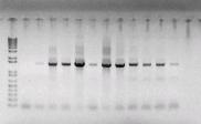 40 A M 1 2 3 4 5 6 7 8 9 10 11 12 M 1 2 3 4 5 6 7 8 9 10 11 12 B ~1500 pb Figura 9: Amplificação do gene do RNAr 16S a partir de DNA obtido de amostras ambientais e de placas pelo método de plate