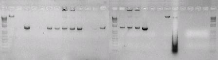 41 M 1 2 3 4 5 6 7 8 9 10 11 12 13 M 14 15 16 17 18 19 M ~1500 bp Figura 10: Amplificação do gene do RNAr 16S com iniciadores específicos para o filo Acidobacteria a partir de DNA obtido de amostras