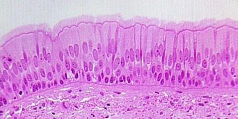 TECIDO EPITELIAL Características Geralmente avascularizado Escassez de matriz extracelular Membrana basal: separa e prende o epitélio ao tecido