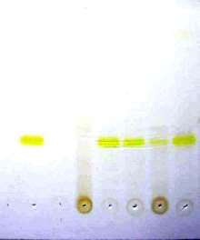 Toxinas: Identificação TLC Thin layer chromatography Tabela - Produção de taxtomina A por isolados de Streptomyces spp.