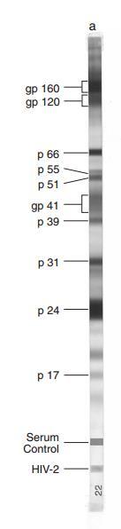 40 Quadro 4: Interpretação das tiras de Western Blot conforme fabricante. PADRÃO INTERPRETAÇÃO TESTE Nenhuma banda específica presente. NEGATIVO Detecção de anticorpos p17 somente.