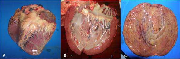 17 Figura 3: Hemorragias no epicardio. B: Hemorragias no endocárdio. C: Mucosa da bexiga apresentando áreas de hemorragia (Coutinho et al., 2013).