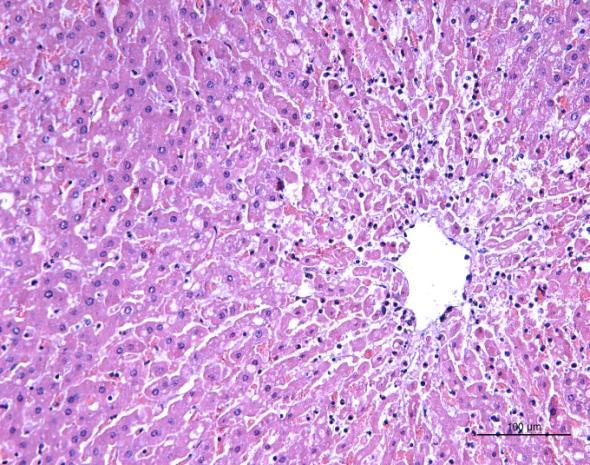 Superfície de corte do fígado caprino (A1), mostrando aspecto de noz moscada. A B Figura 13. Histopatologia hepática de caprino, que recebeu folhas de C.