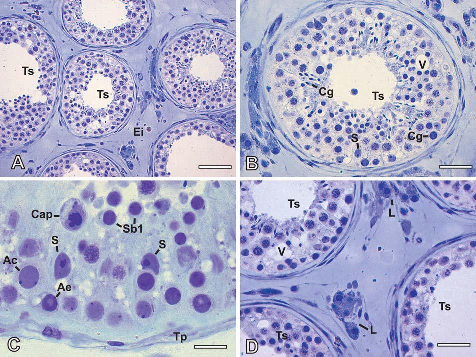 28 Figura 3. Fotomicrografias de túbulos seminíferos de testículos de homens submetidos à fixação em solução glutaraldeído e incluídos em glicol metacrilato.