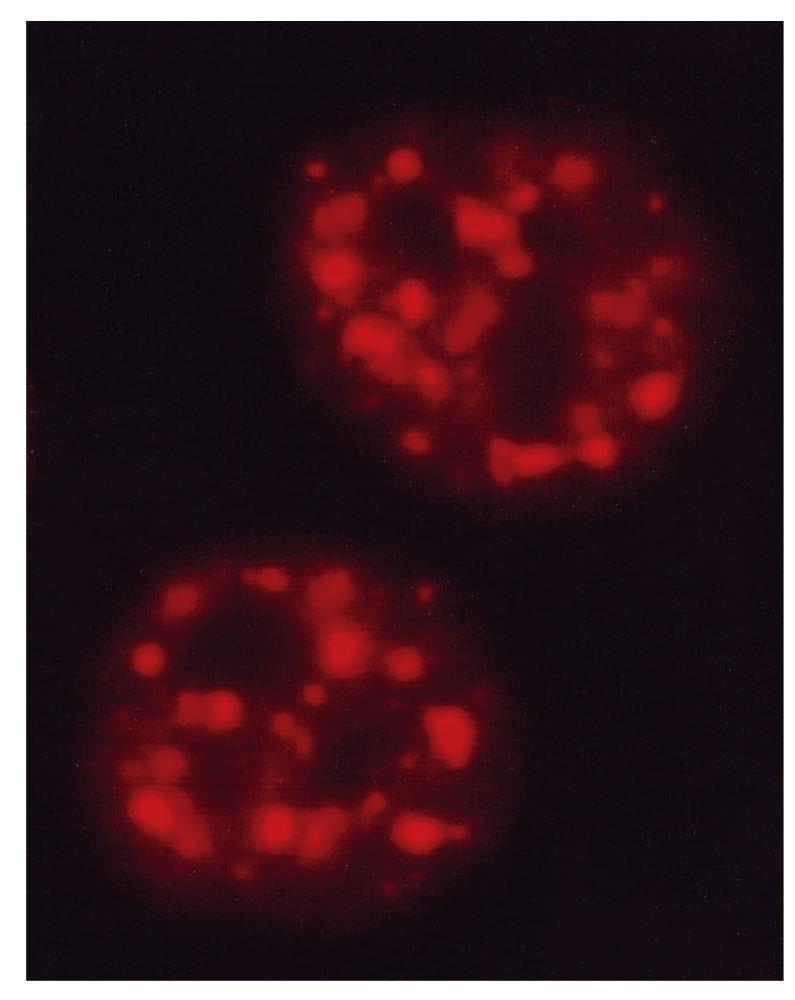 RNA s; Podem ser identificados através de imunofluorescência com anticorpos