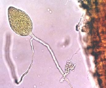 Causas do Declínio- Phytophthora sp.